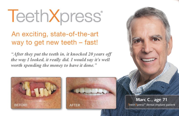 TeethXpress before and after teeth replacement